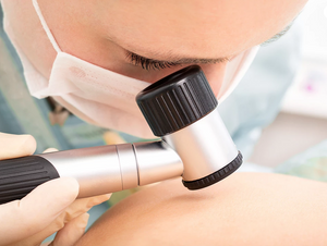 Top 6 Home Remedies To Get Rid Of Stubborn Acne with Extra Virgin Olive Oil